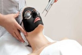 Carbon Peel Carbon Peel