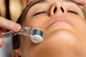 Derma Roller Treatment