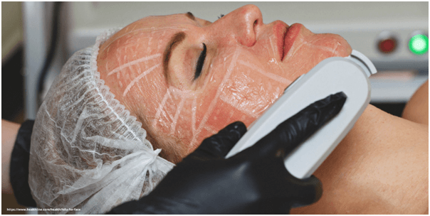 hifu treatment hifu treatment in Hyderabad