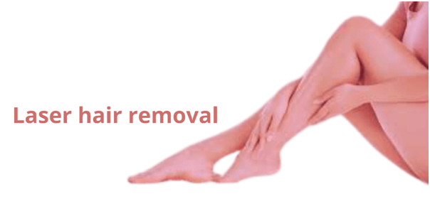 laser hair removal