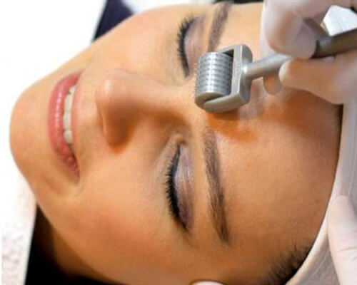 Derma Roller Treatment in Hyderabad