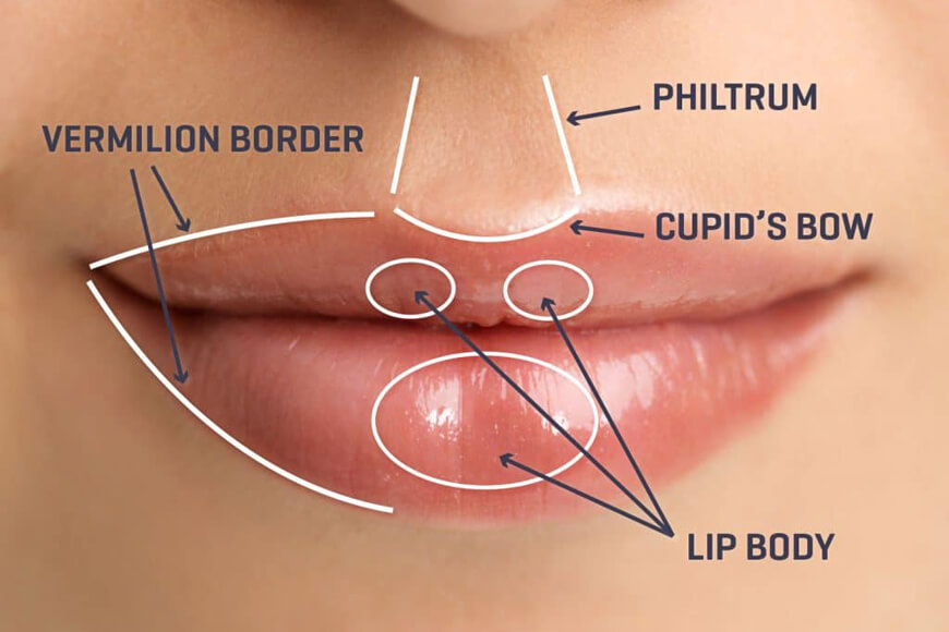 lip augmentatio results