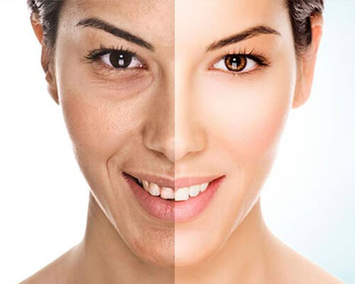 Pigmentation Treatment in Hyderabad